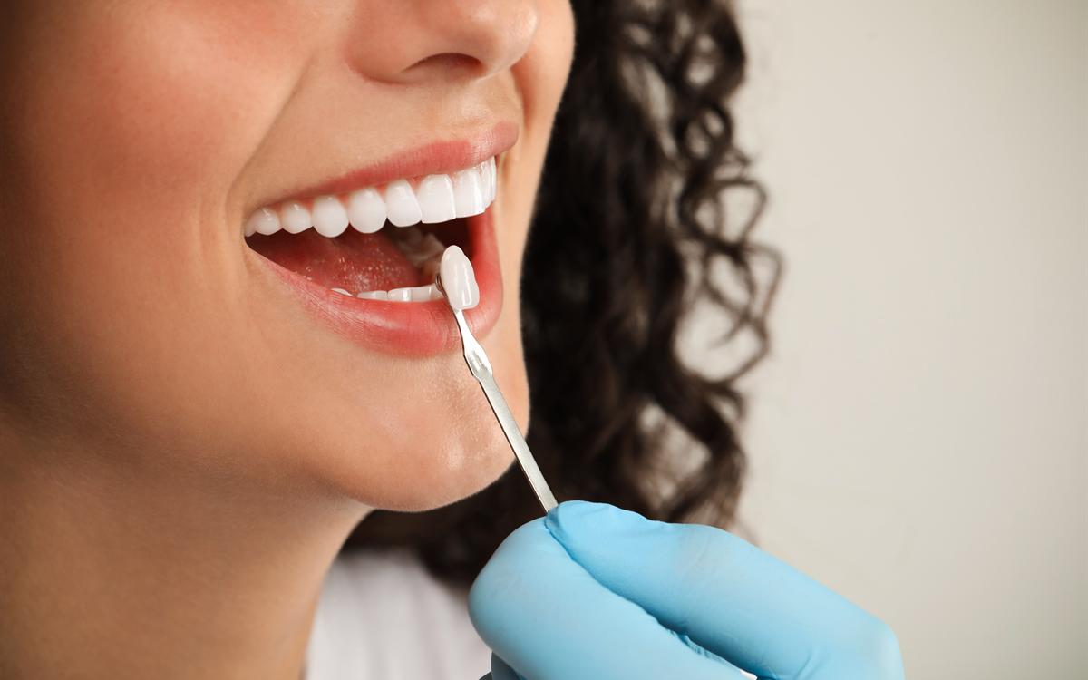El dentista compara una carilla con el color de los dientes de la paciente.